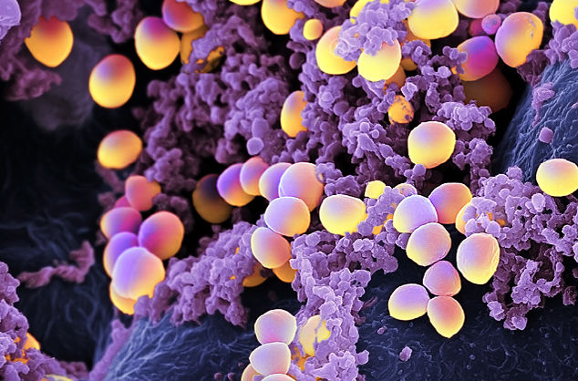 Staphylococcus aureus